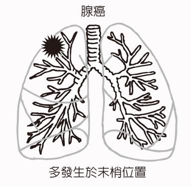 简略图